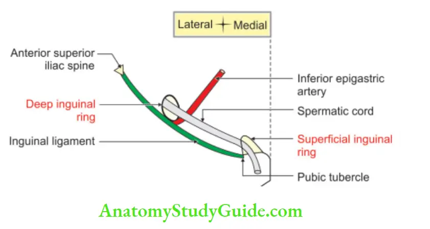 Anterior Abdominal Wall Superficial and deep inguinal rings on right side