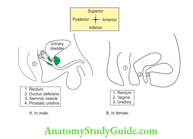 Kidney And Ureter Abnormal sites of opening of the ureter