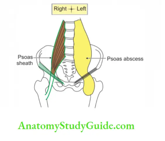 Kidney And Ureter Normal psoas sheath