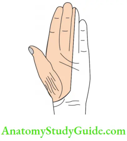 Scapular Region Ape Hand 1.Adduction Of Thumb 2. Lateral Rotation Of Thumb 3.Wasting Of Muscles Of The Thenar Eminence
