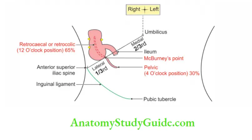 Small and Large Intestines Common positions of appendix