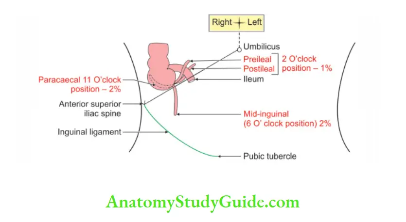 Small and Large Intestines Less common positions of appendix