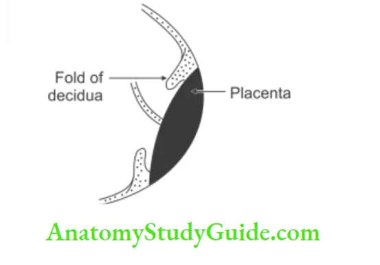 The Placenta Circumvallate