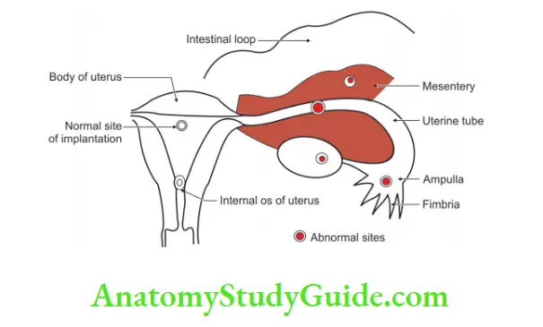 The Placenta Normal and abnormal sites of implantation