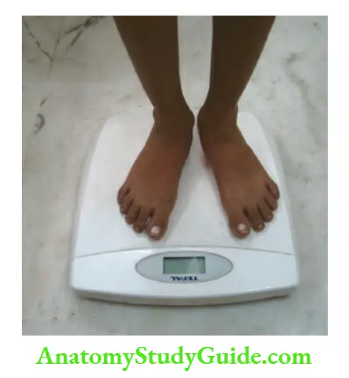 Anthropometry for Assessment of nutritional status Weighing Weighing the child on an electronic digital readout type of weighing scale with a resolution of ±100 g.
