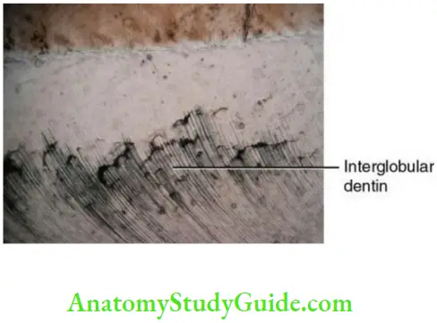 Dentin interglobular dentin