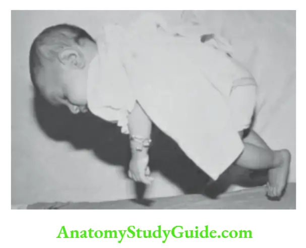Developmental assessment Head is momentarily lifted up on ventral suspension in a 4-week-old infant