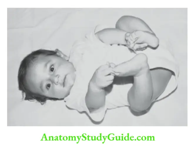 Developmental assessment Holds feet and tries to put toes in the mouth at 16–20 weeks.