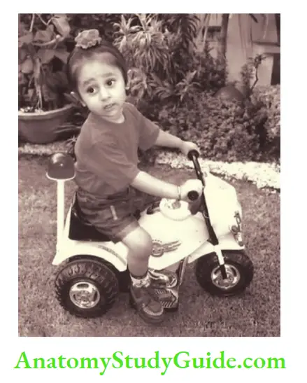 Developmental assessment Rides tricycle at 3 years age.