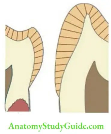 Enamel direction of enamel rods primary and permanent teeth