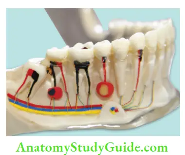 Endodontics Introduction Notes Model of teeth showing plup along with endodontic lesions of the teeth