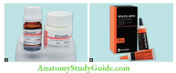 Endodontics Introduction Notes Traditionally used Zinc oxide Eugenol sealer, MTA based root canal sealer.