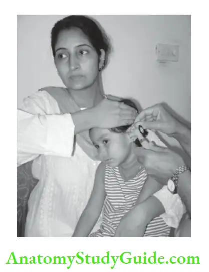 General physical Position and restraining the child for otoscopic examination of the ear.