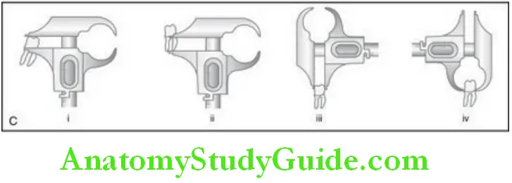 Introduction To Dental Anatomy And Landmarks measurements of the teeth