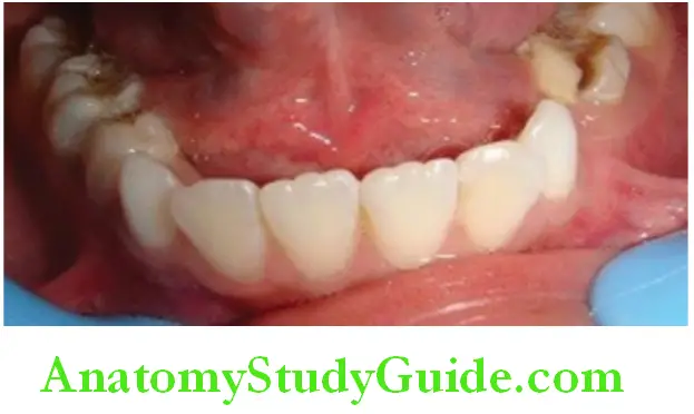 Introduction To Dental Anatomy And Landmarks memolons