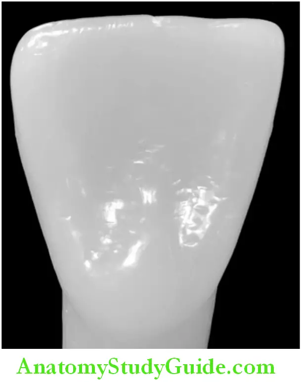 Introduction To Dental Anatomy And Landmarks palatal surface in an anterior tooth