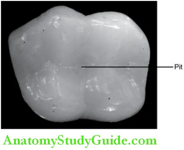 Introduction To Dental Anatomy And Landmarks pit