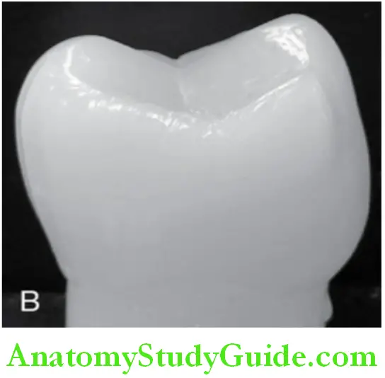Introduction To Dental Anatomy And Landmarks proximal surface in a posterior tooth