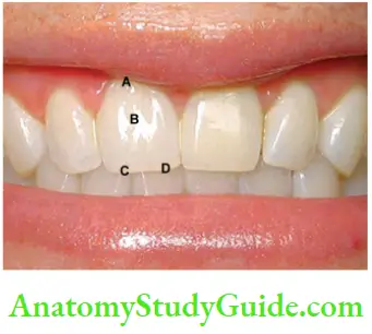 Management Of Discolored Teeth Normal Anatomical landmarks Of Tooth