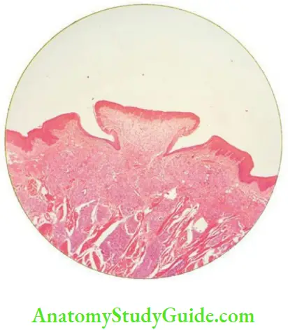 Oral mucous membrane circumvallate papilla