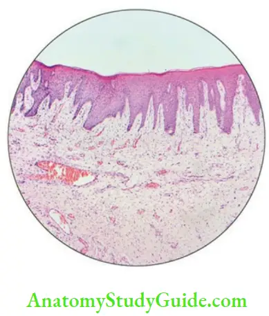 Oral mucous membrane keratinized epithelium.