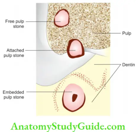 Pathologies Of Pulp And Periapex Notes Types of pulp stones according to location.