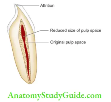 Pulp And Periradicular Tissue Notes Reduction in size of pulp cavity because of formation of secondary and tertiary dentin.