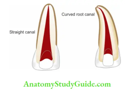 Pulp And Periradicular Tissue Notes Straight and curved root canal.