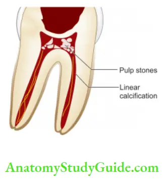 Pulp And Periradicular Tissue Notes pulp stones and reduced size of pulp cavity with advancing age.