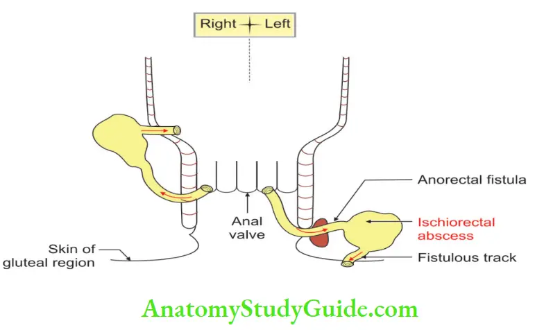 Rectum And Anal Canal Fistulous openings