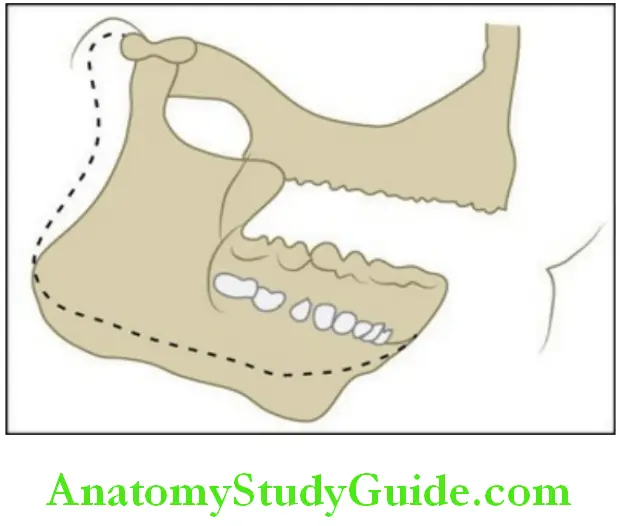 Temporomandibular joint rotation of the condyle