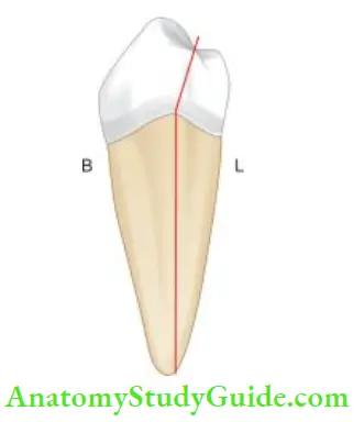 Access Cavity Preparation Due to lingual inclination of mandibular premolar