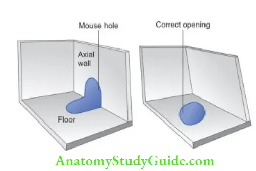 Access Cavity Preparation Mouse hole effct- Mouse hole effct—due to under extension of axial wall, orifie opening appears partly in axial wall and partly in flor; Correct opening.