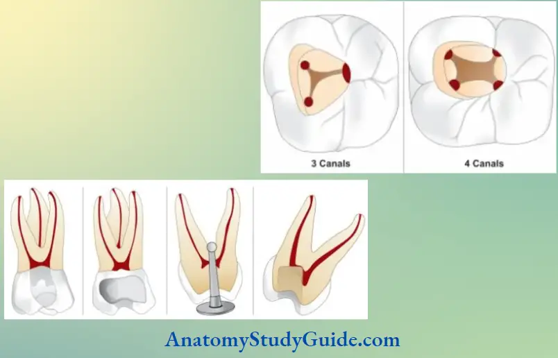 Access Cavity Preparation Notes Mandibular First Molar