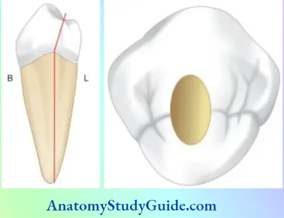 Access Cavity Preparation Notes Mandibular First Premolar