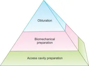 Access Cavity Preparation Pyramid of endodontic treatment.