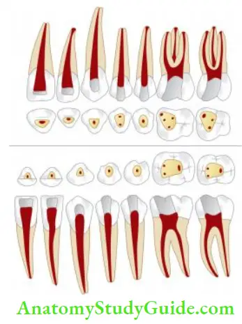 Access Cavity Preparation Shapes of access opening of maxillary and mandibular teeth.