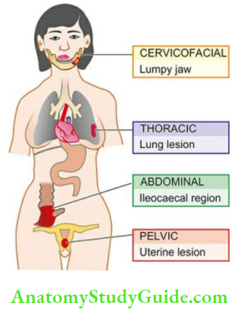 Actinomycosis Etiology Clinical Features Actinomycosis Sites And Routes Of Infection