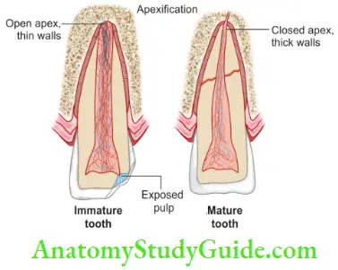 An immature tooth has an open apex and thin walls;A mature tooth has a closed apex and thick walls