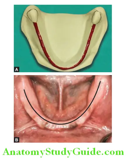 Anatomical Landmarks Edentulous Mandibular Arch crest of residual alveolar ridge