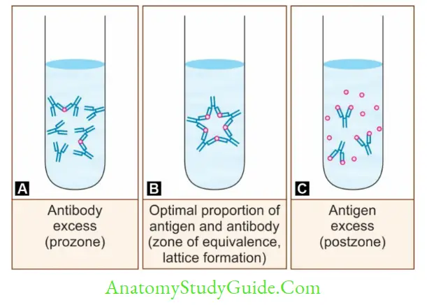 Antigen, Antibody, Antigen-Antibody Reaction, and Complement A. Prozone; B. Zone of equivalence; C. Postzone