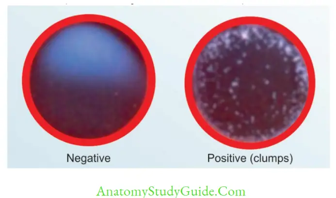 Antigen, Antibody, Antigen-Antibody Reaction, and Complement Passive (latex) agglutination test