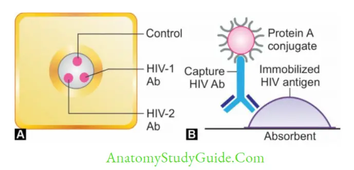 Antigen, Antibody, ntigen-Antibody Reaction, and Complement Flow-through assays. A. HIV TRI-DOT assay for HIV 1 and 2 antibodies detection; B. Principle of HIV TRI-DOT