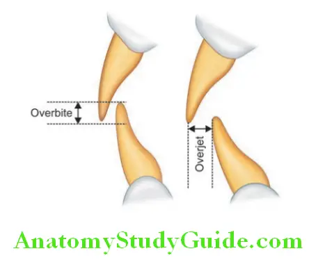 Arrangement Of Artificial Teeth line diagram representing overbite and overjet