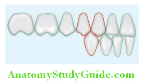 Arrangement Of Artificial Teeth line diagram showing contact of mandibular first premolar with maxillary teeth