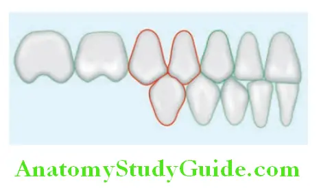 Arrangement Of Artificial Teeth line diagram showing contact of mandibular second premolar with maxillary teeth