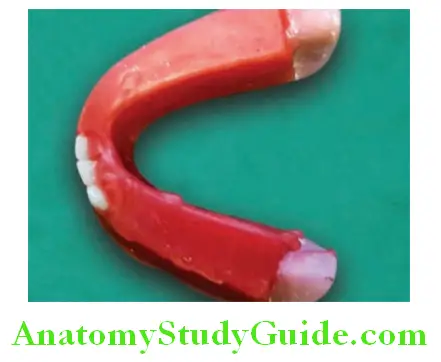 Arrangement Of Artificial Teeth mandibular canine occlusal view