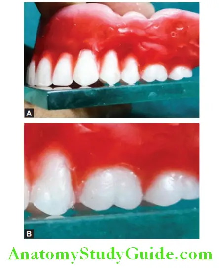 Arrangement Of Artificial Teeth maxillary second molar in occlusal ralation none of the cusp is in contact with glass plate