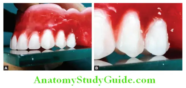 Arrangement Of Artificial Teeth maxillary second premolar in occusal relation appreciate both the palatal and buccal cusps are in contact with glass plate