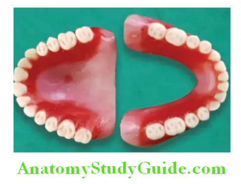 Arrangement Of Artificial Teeth zero degree teeth arranges for maxillary and mandibular dentures